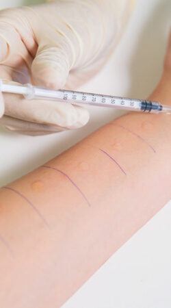 Here’s how you can get your allergies detected